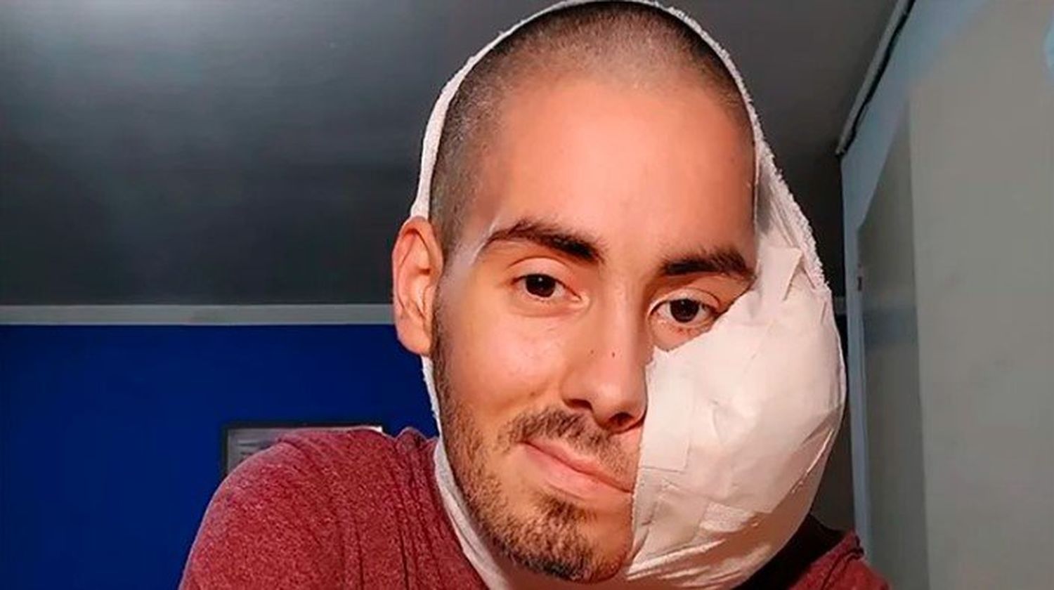 Murió Sebastián Amurín, el joven que tenía un extraño tumor en el rostro