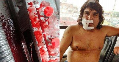 González Catán: Se negaron a pagar el boleto y desfiguraron al colectivero 