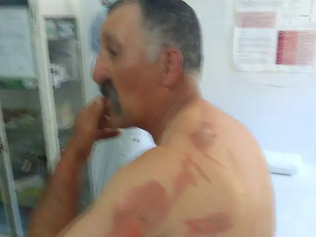 Tres personas fueron torturadas durante un violentísimo asalto  
