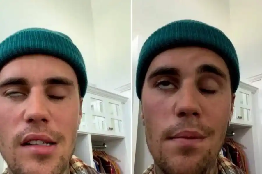 Justin Bieber tuvo que suspender sus show a causa de una enfermedad: ¿qué le ocurrió?