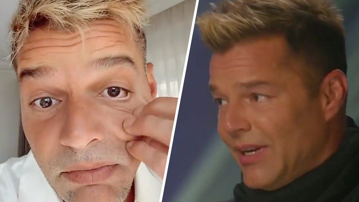Ricky Martin negó haberse hecho cirugía: su explicación de por qué le cambió la cara