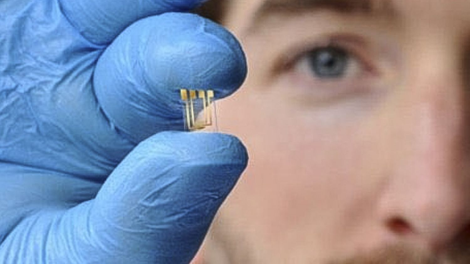 Un chip argentino detecta qué pacientes de Covid-19 necesitarán terapia intensiva