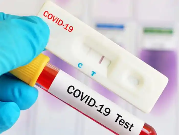 Covid: Otro sábado con muchos contagios y ya hay más de 67 mil muertos