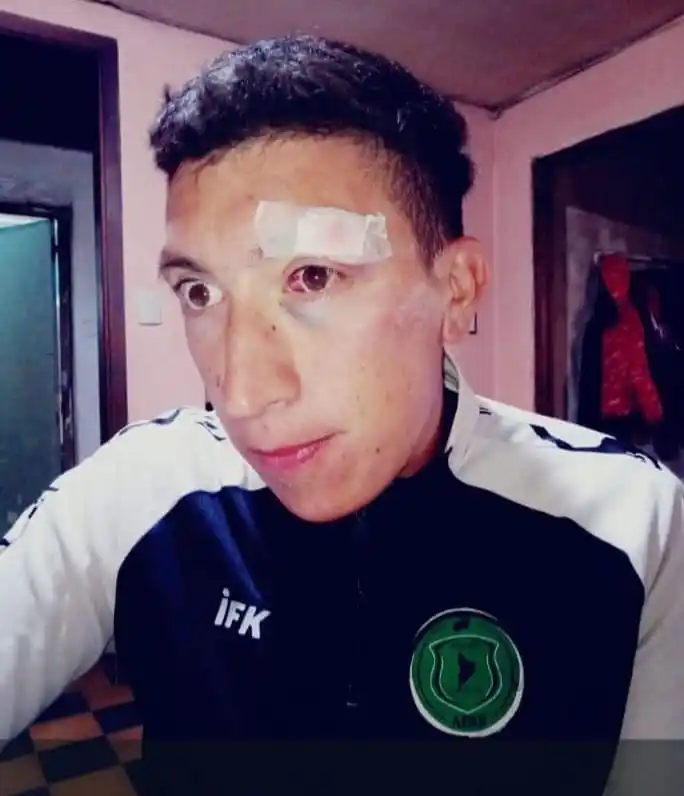 Agredieron al árbitro Jonatan Fernández en la Copa Baratteri