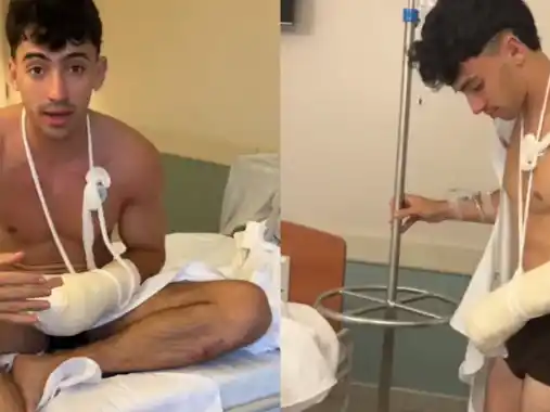 Gero Arias pierde dos dedos en un accidente extremo