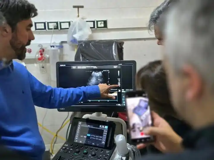 El Hospital Centenario puso en funcionamiento el ecógrafo donado por Rotary Oeste