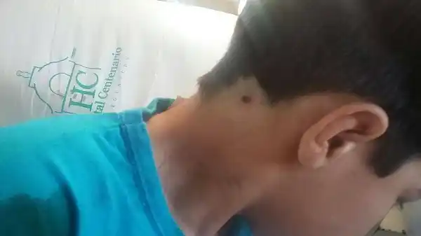 Disparó contra un grupo de chicos y baleó a uno en la nuca 