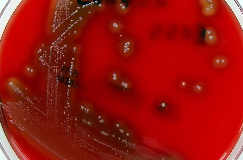 Afirman que aumentó el número de casos de streptococcus pyogenes