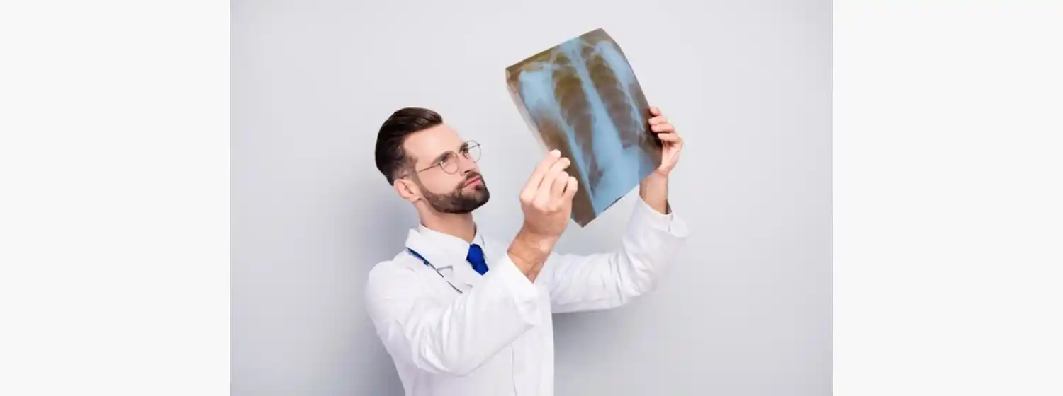 Día mundial de la Tuberculosis