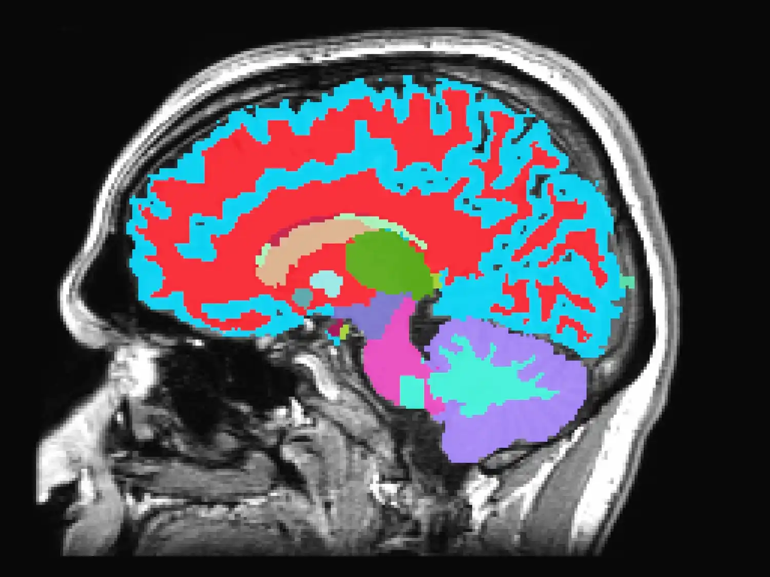 Un simple escáner cerebral determina la velocidad a la que envejecemos