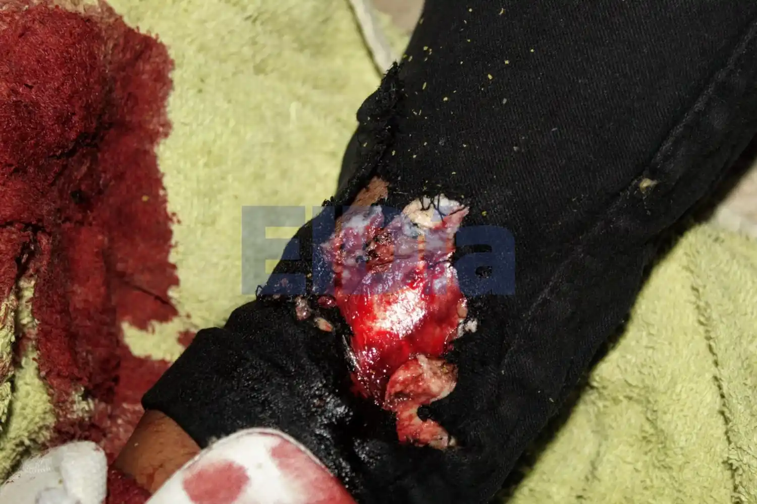 Un conflicto entre vecinos terminó con un herido de bala de goma y un policía denunciado