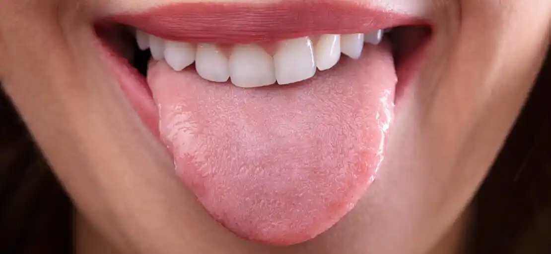 Impresionante: ¿la lengua más larga del mundo?