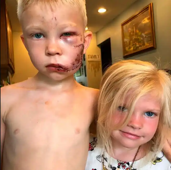Un niño héroe salvó a su hermana del ataque de un perro: "Si alguien debía morir..."