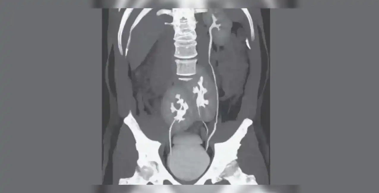 El paciente tenía un punzante dolor en la zona lumbar.