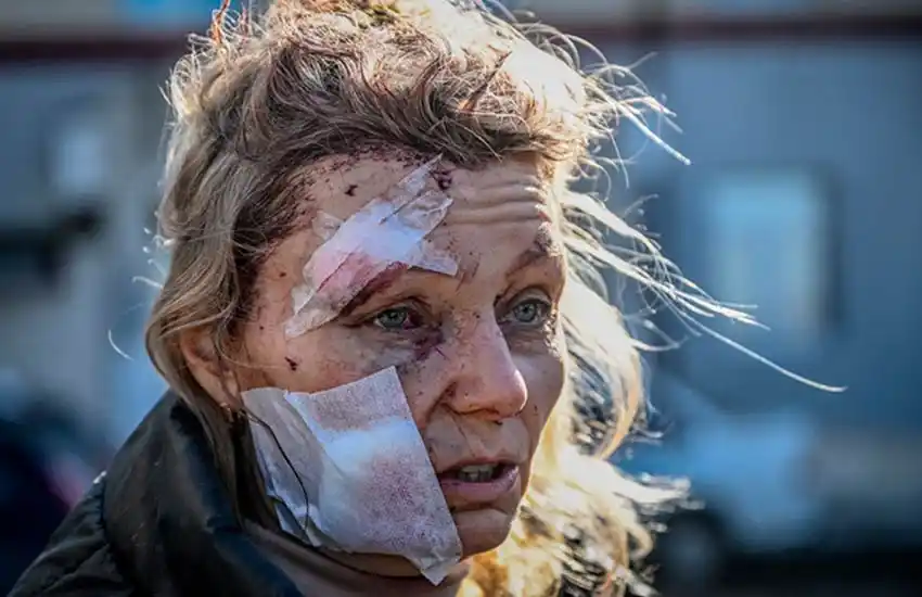 Según la ONU, ya son más de 500 los civiles muertos en Ucrania tras la invasión rusa