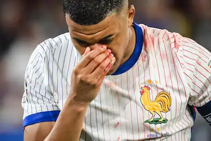 Mbappe