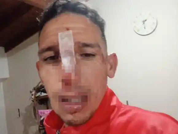 Fue a la cancha con sus hijos y terminó desfigurado: brutal golpiza tras un partido de la liga regional en Tres Arroyos