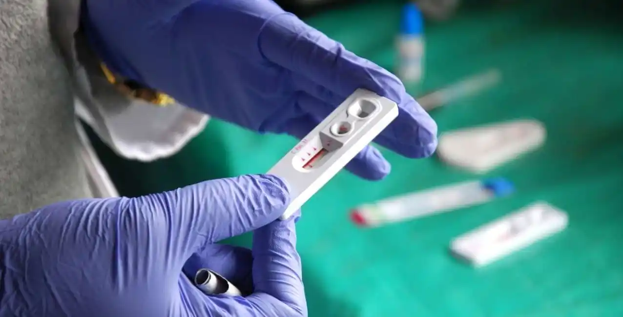 Primer autotest de saliva para la detección de HIV en el mercado