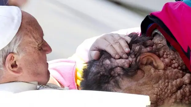 Francisco pidió solidaridad y comprensión para una persona enferma