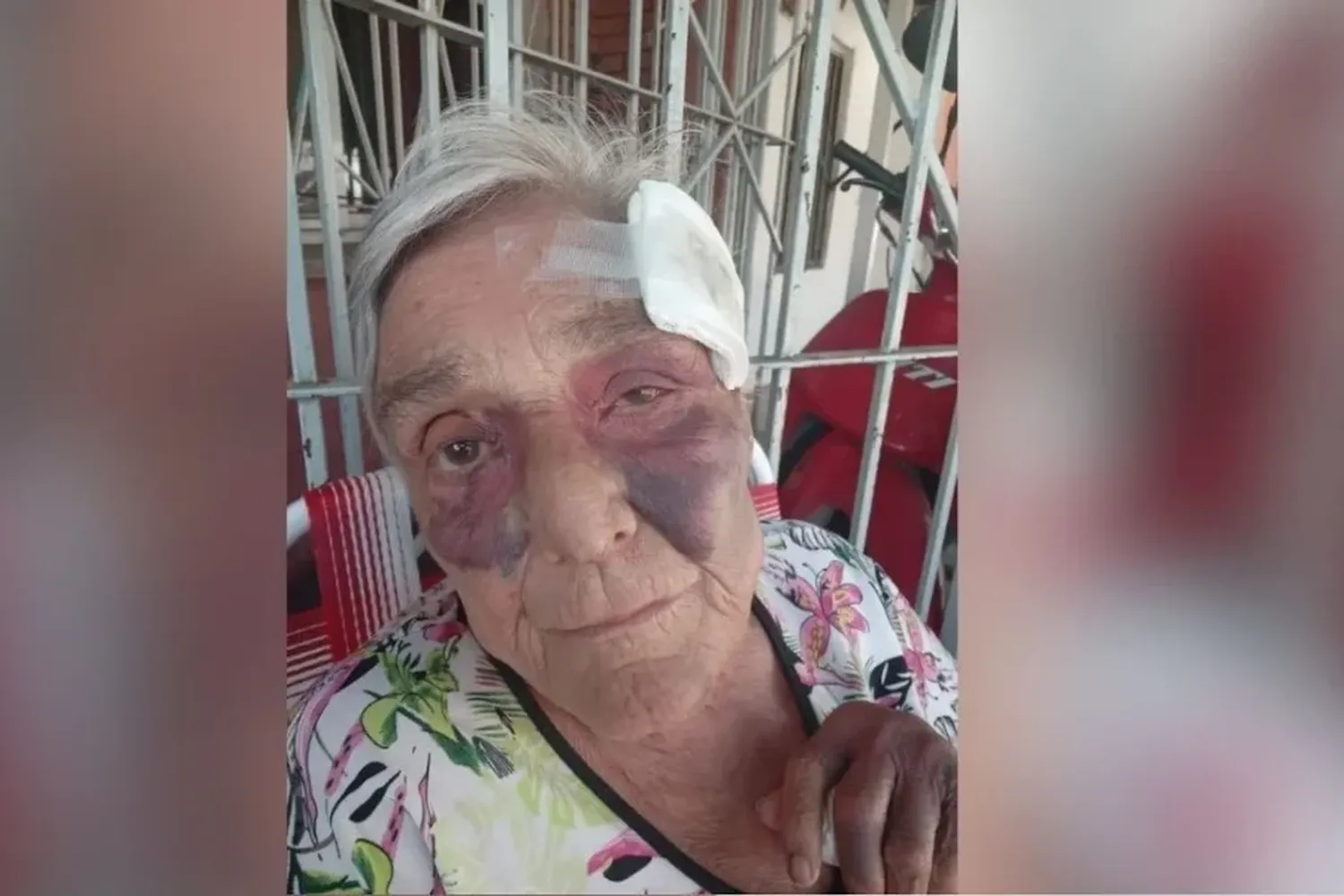 En pleno mediodía de sábado, golpearon violentamente a una mujer de 78 años para robarle el automóvil