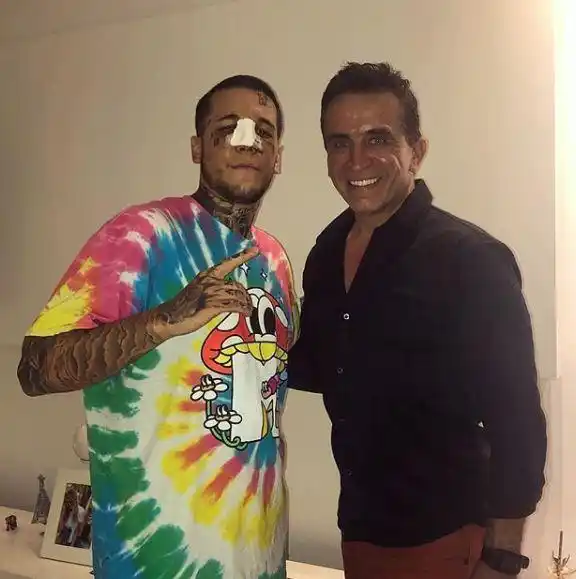 Alex Caniggia se operó la cara y advirtió: “¡Tiembla Brad Pitt!”