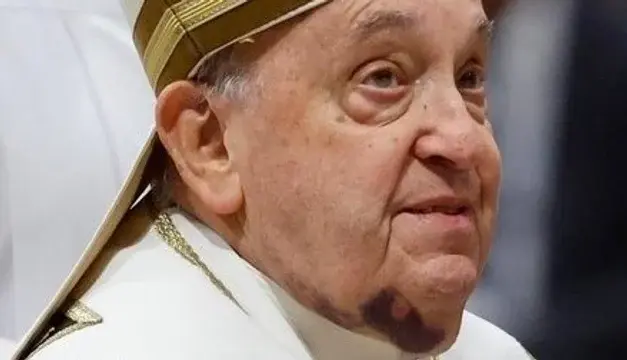 Se complejiza el estado de salud del Papa: padece neumonía bilateral