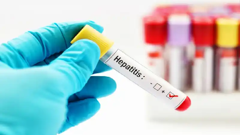 La hepatitis no puede esperar
