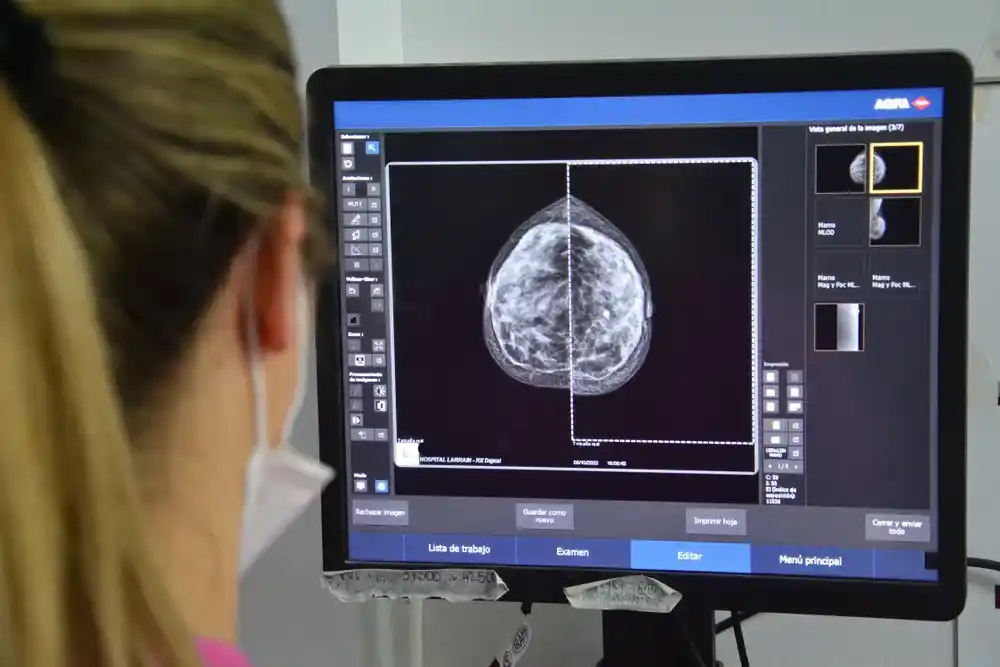 Prevención del cáncer de mama: el gobierno bonaerense comenzará a indicar la mamografía a los 40 años