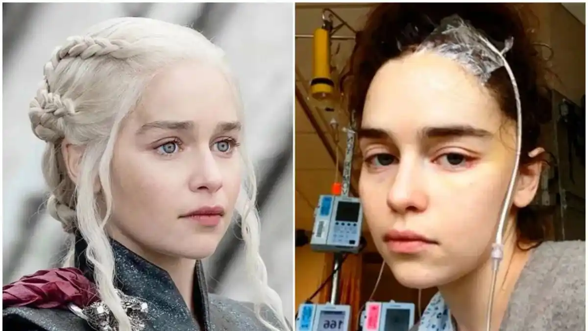 Emilia Clarke reveló que dos aneurismas le dejaron parte del cerebro inutilizable
