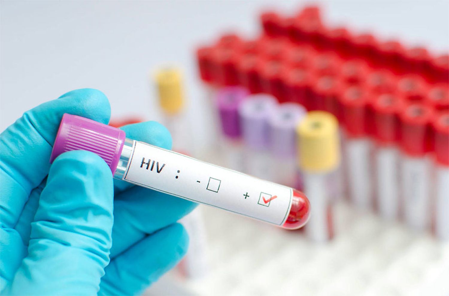 Prueban en humanos una vacuna contra el VIH con tecnología de ARN