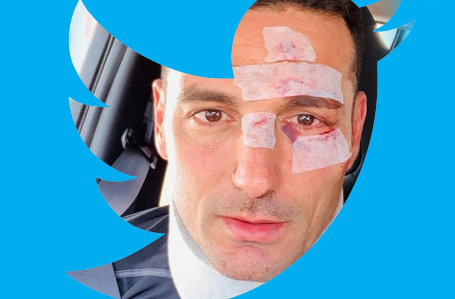 Estallaron los memes de Scaloni luego del accidente