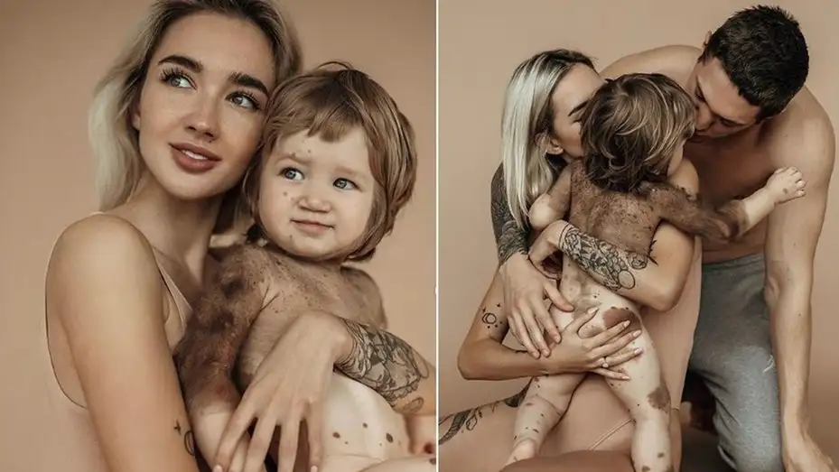 Influencer mostró en redes sociales la extraña enfermedad de su pequeño hijo