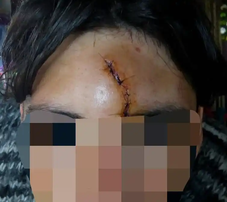 Ataque “piraña”: golpean y asaltan a un joven en la calle