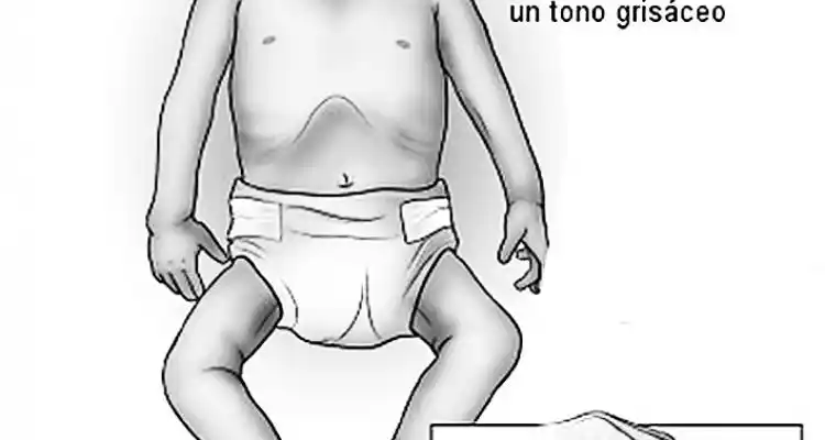 La deshidratación y la desinformación cobraron la vida de un bebé