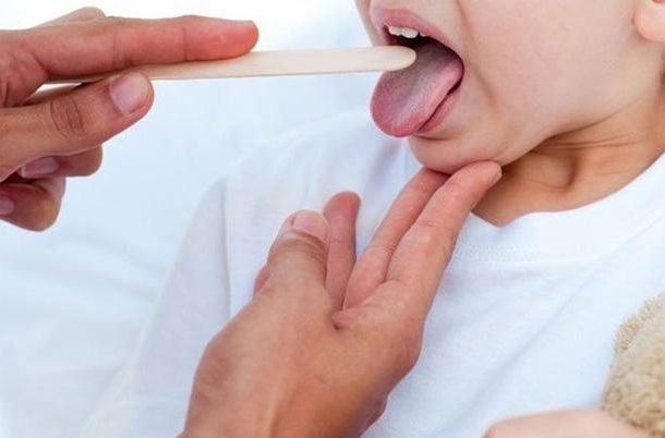 Un pequeño de dos años falleció a raíz de una infección provocada por estreptococo