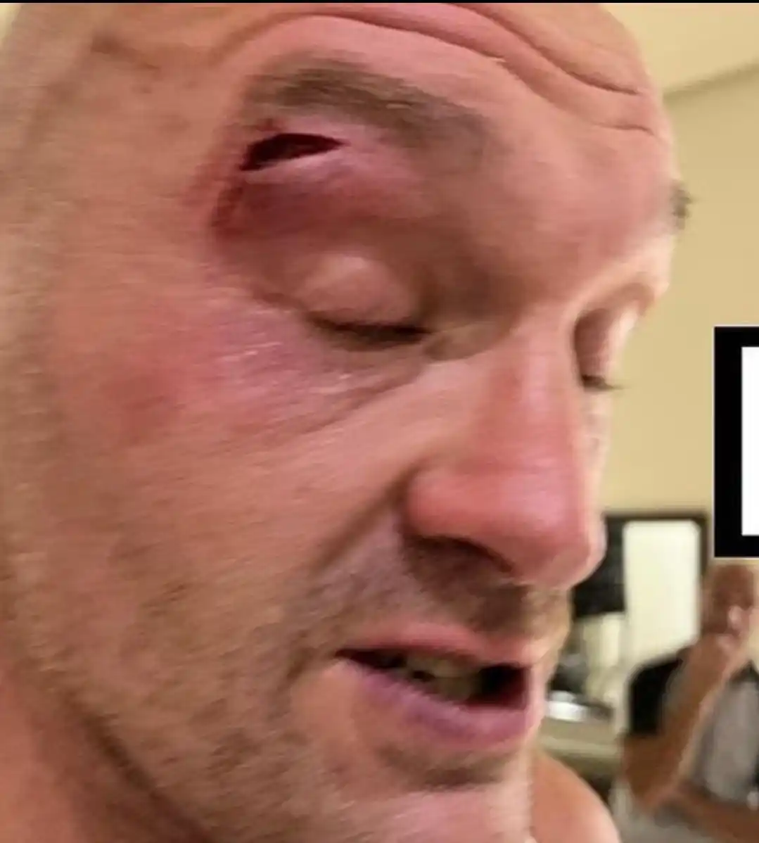 Por un corte, se reprogramó la pelea de Fury y Usyk.