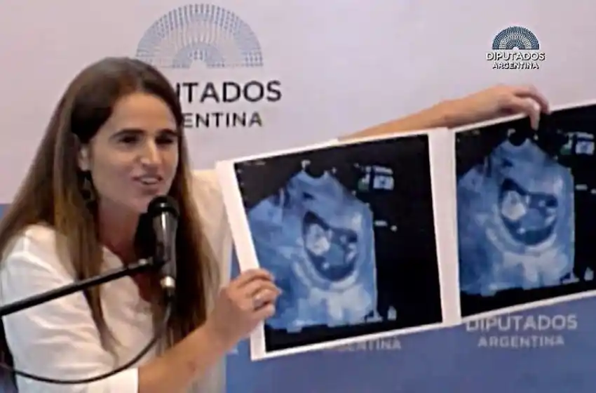 “Un bebe fruto de una violación y uno del amor, no se diferencian”