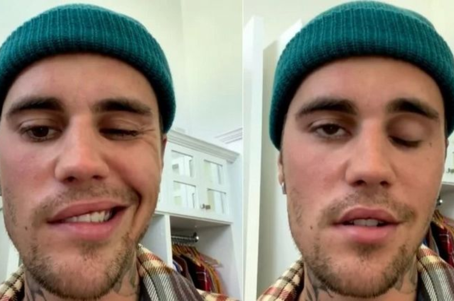 Justin Bieber canceló sus shows: un virus le provocó parálisis facial