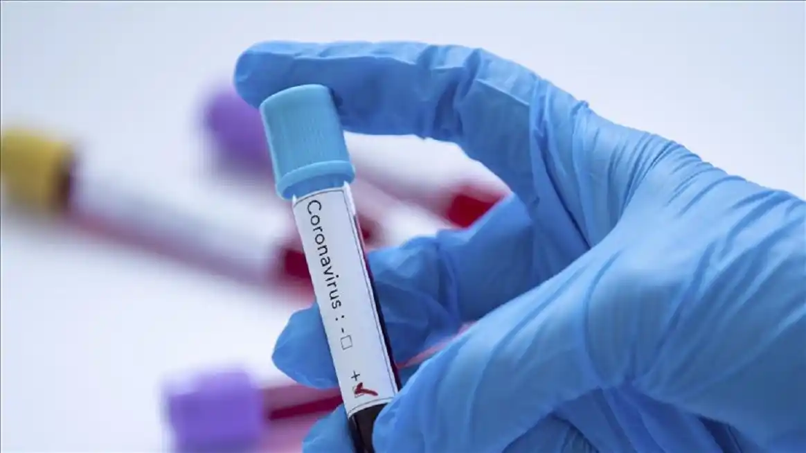 Se realizó un estudio contra el Covid a 50 vecinos de Larroque 