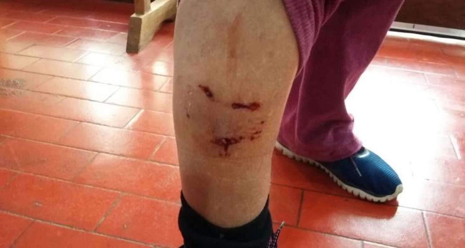 Iba en moto y la mordió un perro en pleno centro