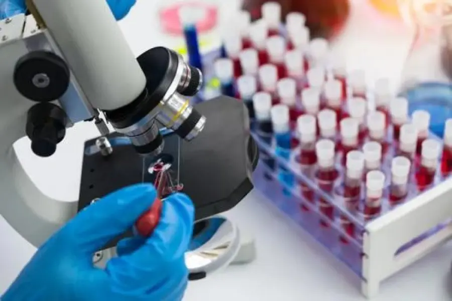 Avances contra el VIH: encontraron una proteína que ayuda a que el virus no se active