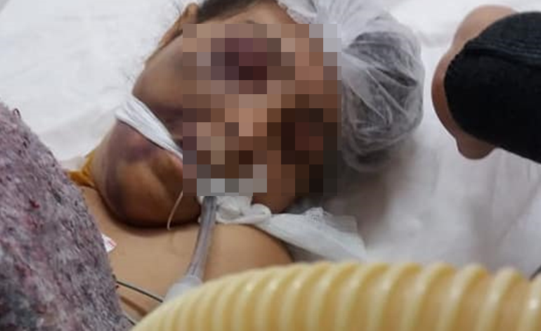 Baradero: Denuncian maltratos en APAND a joven discapacitada