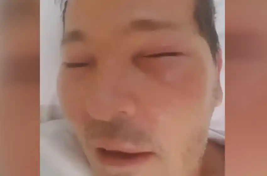 Guido Süller está internado con el rostro desfigurado