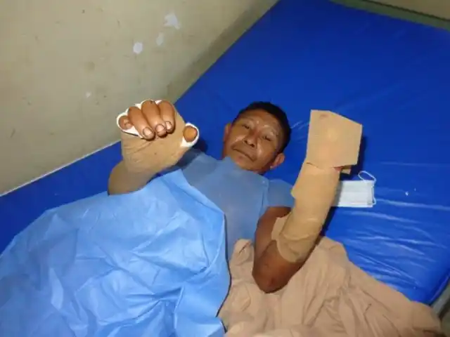 RIÑA entre indígenas deja un muerto y varios heridos en Delta Amacuro