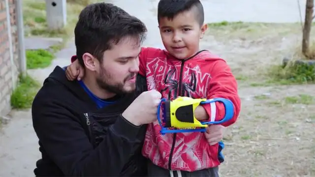 El joven argentino que creó prótesis 3D para niños lamentó el dólar turista