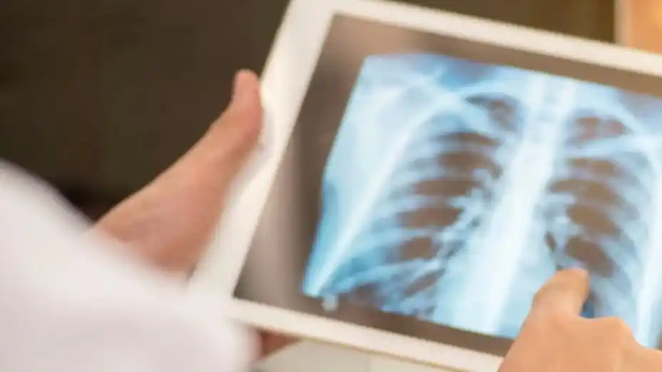 Alerta por el avance de otras enfermedades mortales a la sombra del coronavirus