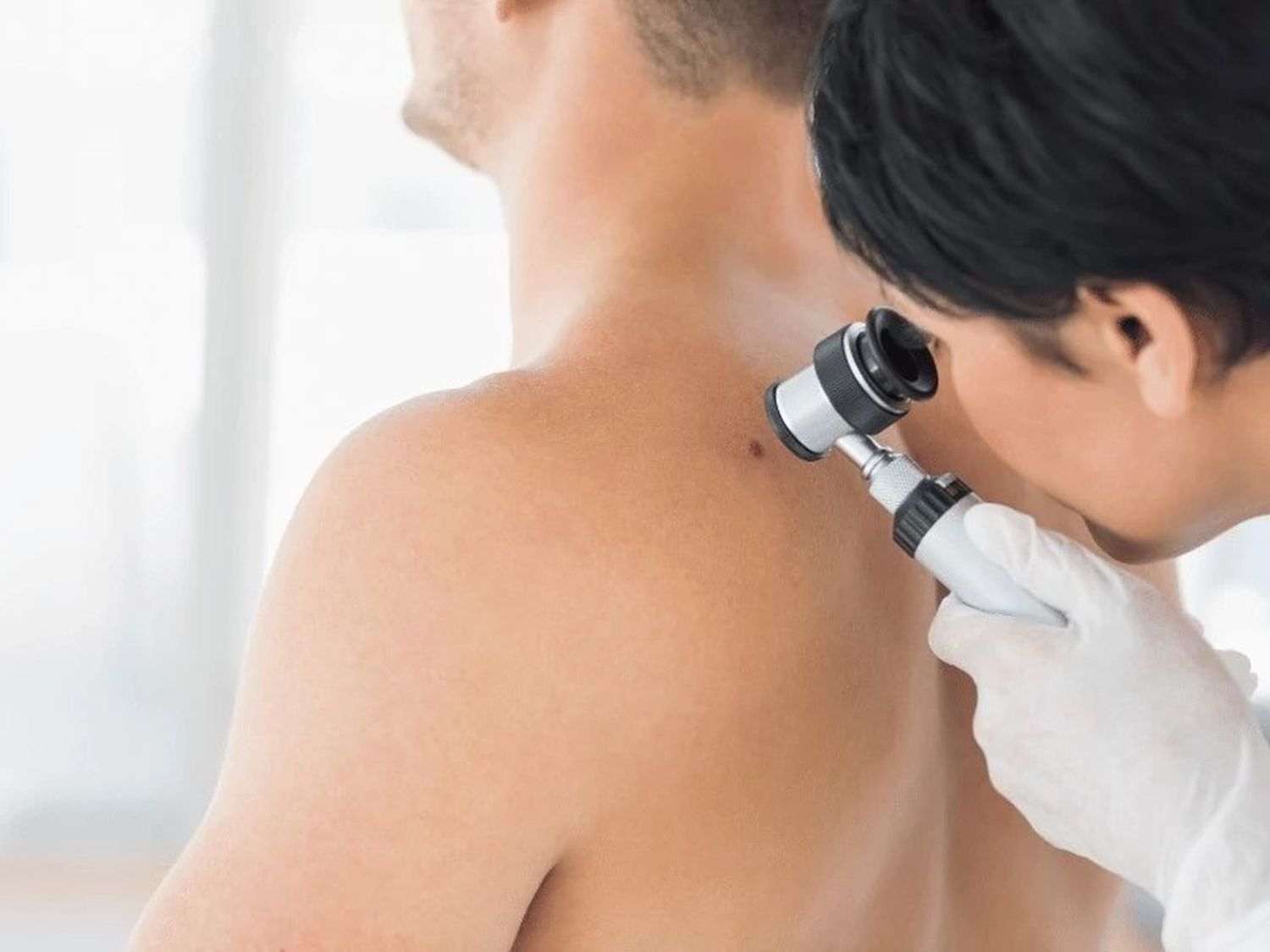 Día Mundial del Cáncer de Piel: la importancia de la prevención y el diagnóstico precoz