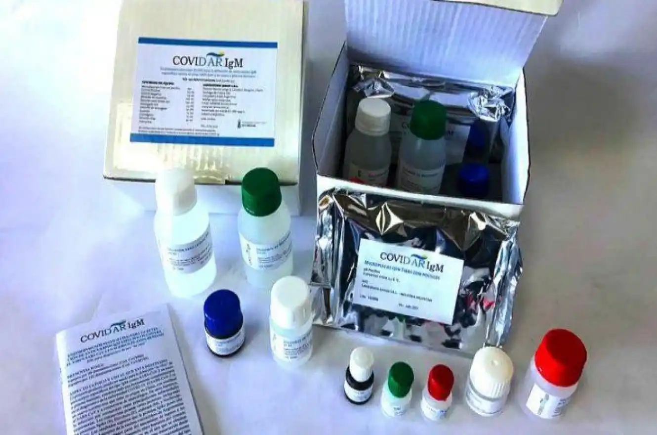 Coronavirus: Presentaron el test rápido para detectarlo