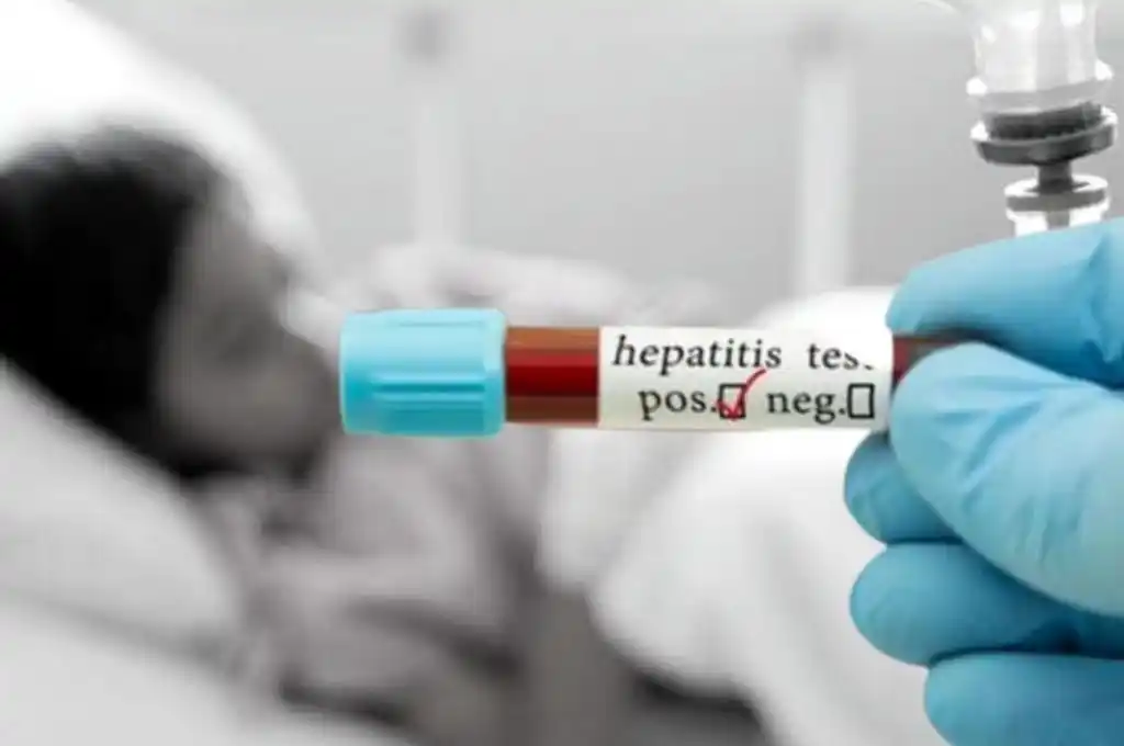 México reporta sus primeros casos de hepatitis aguda infantil