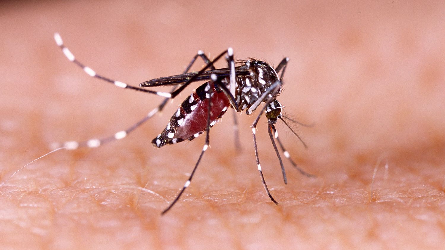 Dengue.